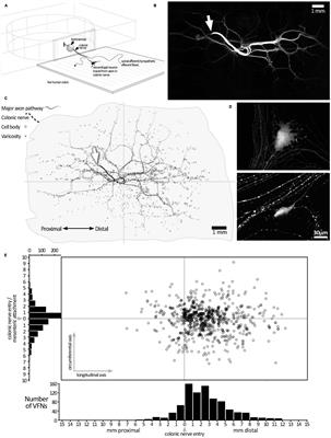 Characterization of viscerofugal neurons in human colon by retrograde tracing and multi-layer immunohistochemistry